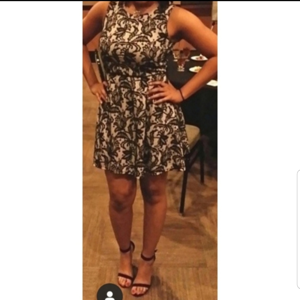 🔴Black lace dress